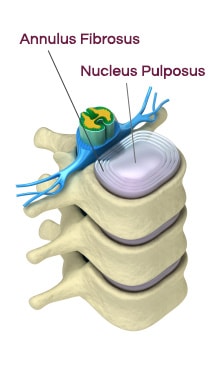 Inside Spinal Disc - Annulus Fibrosus - Nucleus Pulposus