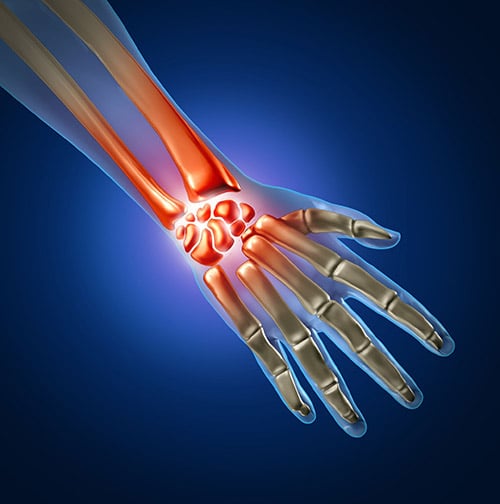 carpal tunnel relief carpal tunnel relief