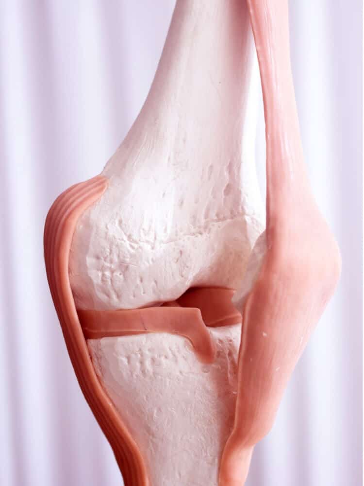 acl-demo