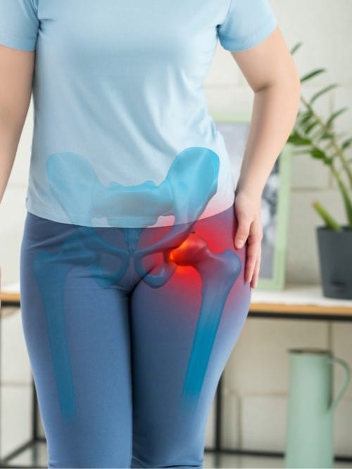 osteoporosis3 Woman holding her hip in pain with an illustration of the hip bone highlighting joint discomfort or osteoporosis.